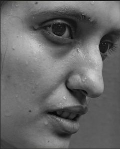 عرق سرد در زنان